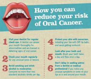 Oral Cancer Prevention