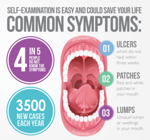 Oral Cancer Symptoms
